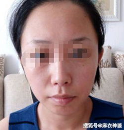 这种面相的人,过于贪图享受,没有大财运,不聚财