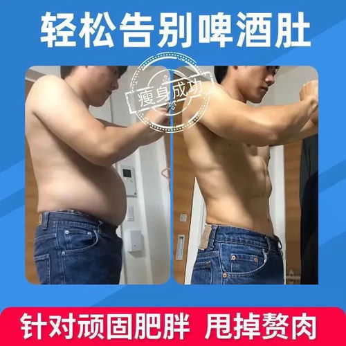 减肥神器懒人瘦身甩脂机腹肌贴肚子减肥器瘦腿神器男女瘦肚子器材