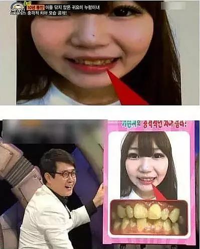 牙黄口臭怎么办有了它,新垣结衣的笑容即刻拥有