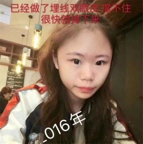 15岁女孩花400多万整容,后悔整太早想知道自己自然长大的样子