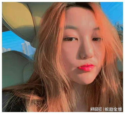 李嫣兔唇并未修复专家一句话撕下王菲遮羞布,原来我们都被骗了