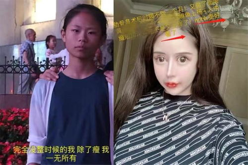 上海整容狂人周楚娜2年砸400万削骨,如今模样硅胶感满满