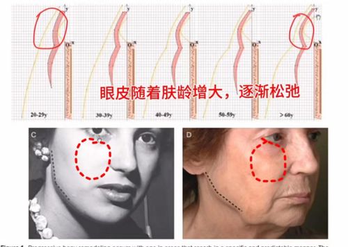 女生眼皮又松又老,怎样紧致眼周美容院专用眼周抗衰攻略,眼袋泪沟鱼尾纹眼窝凹陷等眼部问题一网打尽3步拥有少女眼
