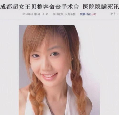 她是时尚界的宠儿,从14岁开始整容至今,直言我上瘾了