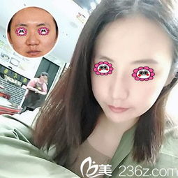 公布扬州施尔美整形2019年全新价格表,单部位吸脂5人成团可享580元优惠