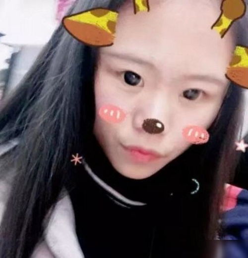 女孩13岁就沉迷整容,三年花费上百万,成真人芭比谁能欣赏