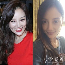 李小璐整容后遗症更明显女星最新素颜照见光死