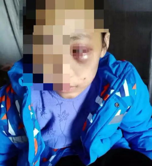 12岁女孩长期遭养母家暴其母回应亲生的,只是教育过重