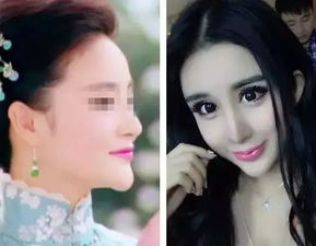 一女子整形失败欲跳楼,骨筋小颜提示你整形前你必须了解的几件事