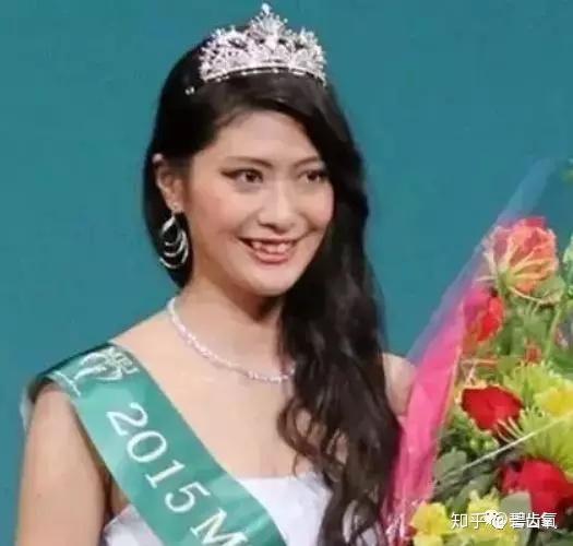 岛国宅男喜欢虎牙妹妹可能也是无奈之举