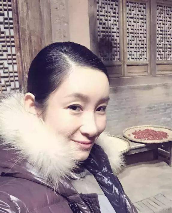 女星割双眼皮如跨分水岭,没整好变悲伤蛙,成功则变气质美女