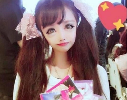 当年那个花上百万整容,只为成为漫画脸的女孩,现在如何