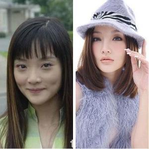 李小璐调整好状态,重新回归家庭,如今却成了锥子脸网友心疼