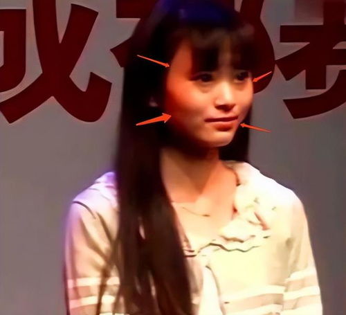 长得歪瓜裂枣,整得美若天仙,这5位女星都靠脸逆天改命