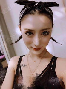 你们的百变女王来了,之前一直都是给人感觉霸气暗黑,...隆鼻失败修复悦美整形