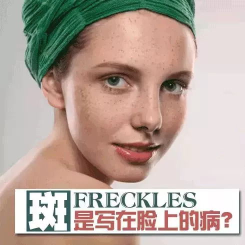 不是淡斑,是真正祛斑,活能白晶臻享星级套