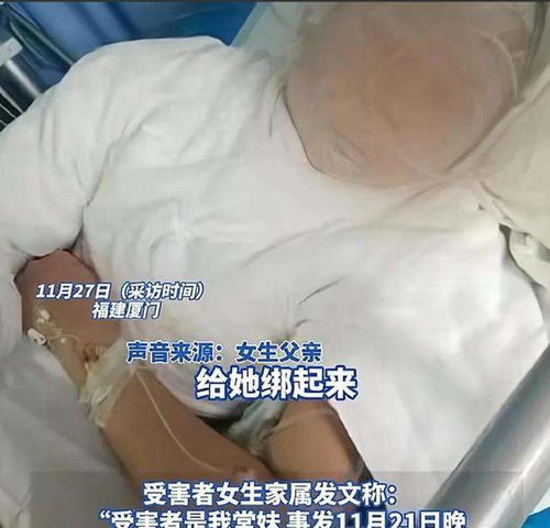 20岁女孩被前男友绑架虐待2天,脸及身体严重烫伤,更多细节披露