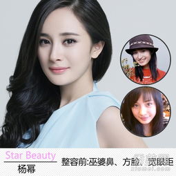 郭采洁疑整容从女星学生照看容貌变化