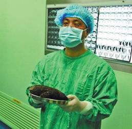 女孩每天这样,从身体取出来的东西让医生傻眼