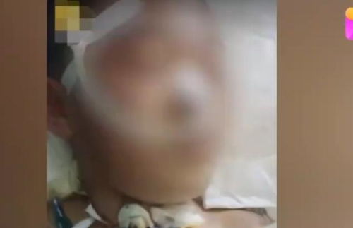 山西12岁女孩被继母打成植物人,生父表示要起诉,生母看众筹平台才知道