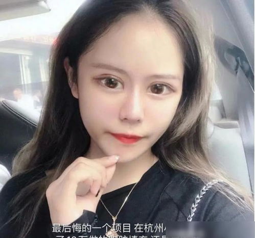 15岁网红整容成瘾,自以为400万变美了很多,晒出照片被质疑60岁