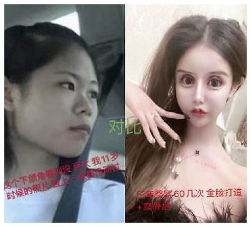 3年整60次,花数百万,网红女孩娜娜,如今吃饭睡觉都成了问题