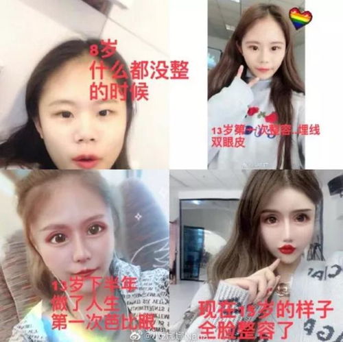 又一个女孩,被整容毁掉了