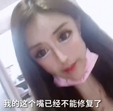 13岁就开始整容的女网红出现后遗症医生称嘴巴缝太多无法修复