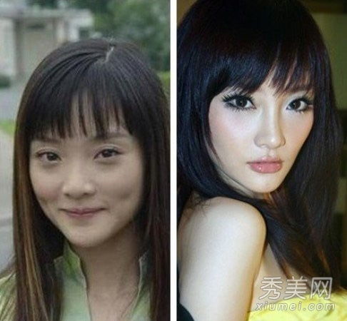 娃娃脸女主角大王菲整容前后痴迷美容针