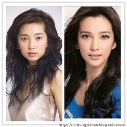 饼脸变锥子脸的30整容女星