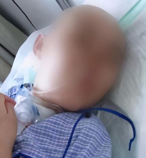 12岁女孩被继母打成植物人,孩子父亲肯定会上诉