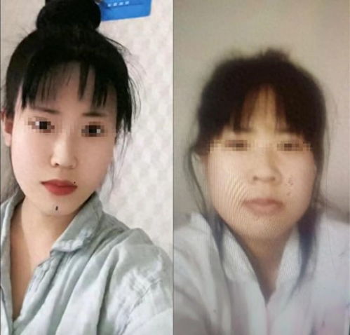 上海24岁女孩整容失败后自杀身亡,前后颜值照曝光