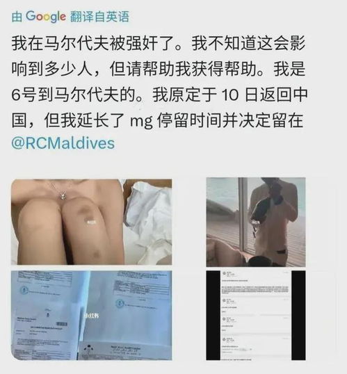 26岁女子马尔代夫度假发生性侵,痛苦经历曝光,照片引网友愤怒