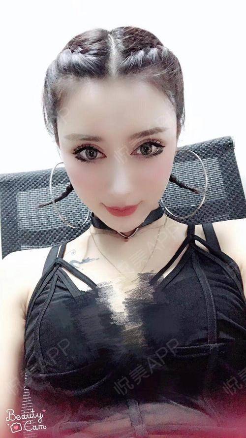 你们的百变女王来了,之前一直都是给人感觉霸气暗黑,...双眼皮悦美整形