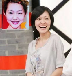 他终于拔掉拖延六年的鲨鱼牙达到颜值巅峰baby高圆圆看明星整牙对形象影响有多大