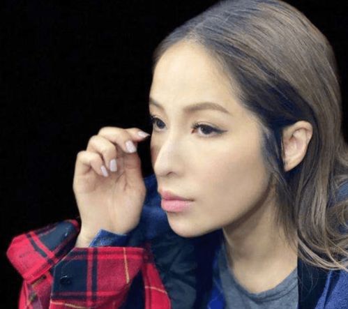 女星割双眼皮如跨分水岭,没整好变悲伤蛙,成功则变气质美女