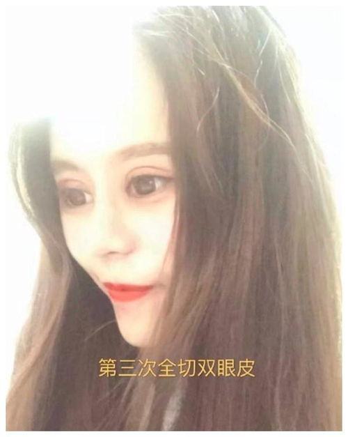 3年整60次,花数百万,网红女孩娜娜,如今吃饭睡觉都成了问题