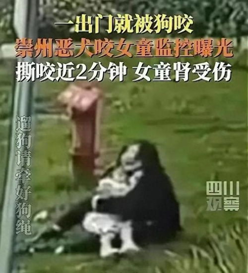 恶犬撕咬2岁女孩后续伤人恶犬主人归案,已被采取刑事强制措施