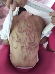12岁女孩遭后妈虐打,打人者已被刑事拘留,生父的话令人气愤