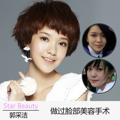 学生照揭女星整容谜团