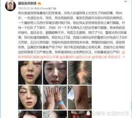 女子西昌旅游被人殴打,打人者一番话意味深长,对方要我赔40万