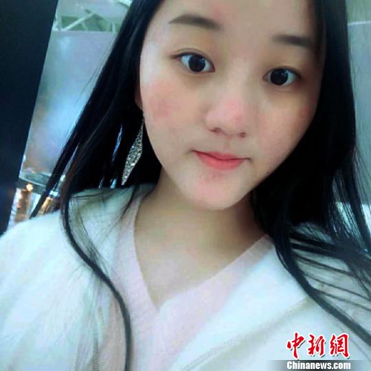 17岁女孩游峨眉山金顶已失联警方和景区正在寻找