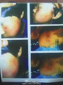 咸阳女老师因闪学生耳光被打手机新浪网
