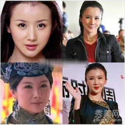 袁珊珊李颖芝女星整容过度大秀硅胶脸