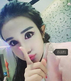 15岁少女整容过度变蛇精高调炫富遭抨击