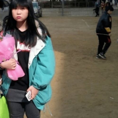 20岁美女网红整容成瘾,隆胸后坦言放了很多假体,痛到脸都肿了