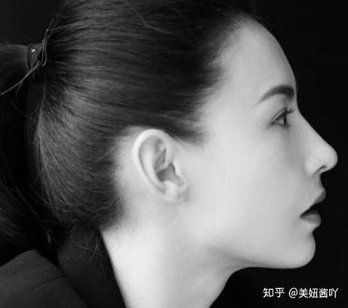 隆鼻失败率高吗