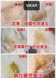 三明老年保健品代理