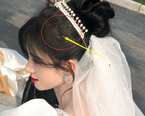 鞠婧祎发际线太迷惑,被发现频繁带假发片,吹开头发却看不见发缝