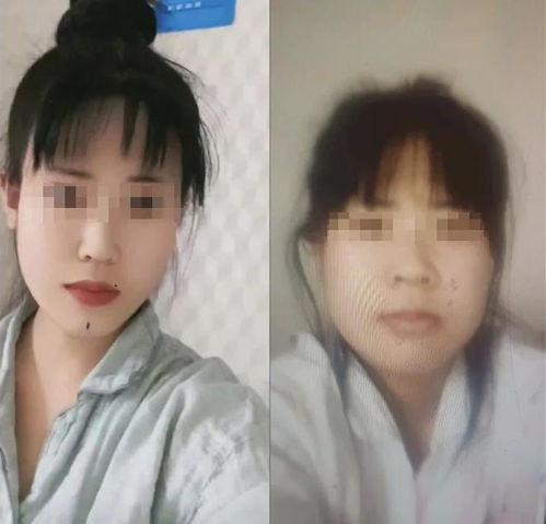 上海24岁女孩整容失败后自杀,前后颜值照曝光,网友太可惜